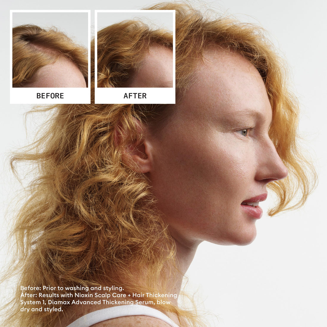 Nioxin Scalp & Hair Leave-In Treatement System 1 (Fine Hair/Normal to Light Thinning), 3.4 oz