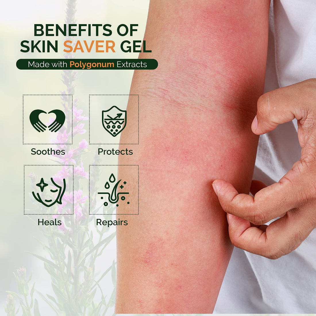 Moraz Skin Saver Herbal Healing Scar Gel for Skin Repair and Wound Care – Multi-Purpose First Aid Moisturizer for Dry Skin, Minor Cuts and Scrapes, Bug Bite Itch Relief, Sunburn & Rashes (1.7 Oz)