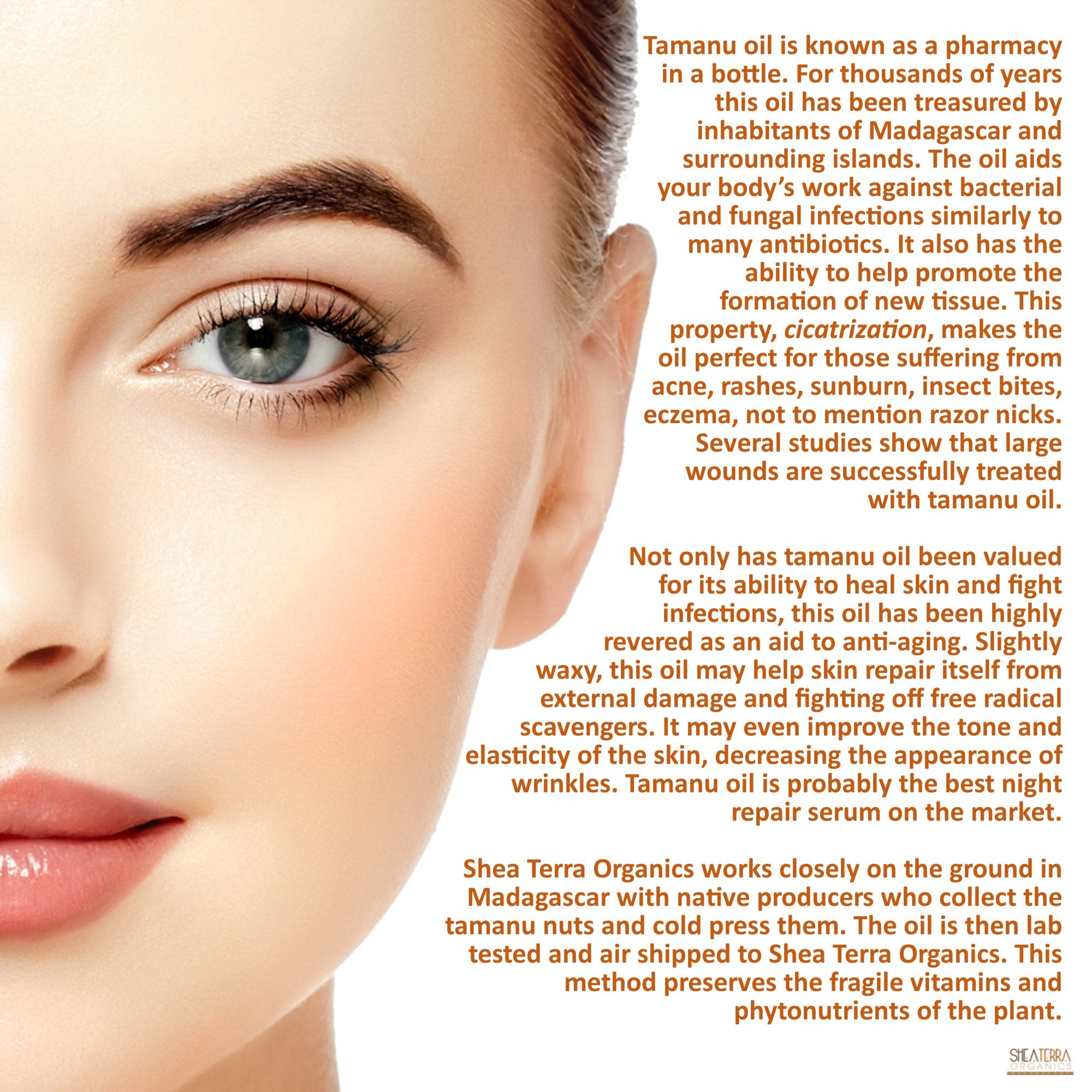 Shea Terra Madagascar Tamanu Cold-pressed Extra Virgin Oil |All Natural & Organic Oil Rich in Anti-Aging Amino Acids & Anti-Acne Properties for Softer, Hydrated & Blemish-Free Skin – 2 oz