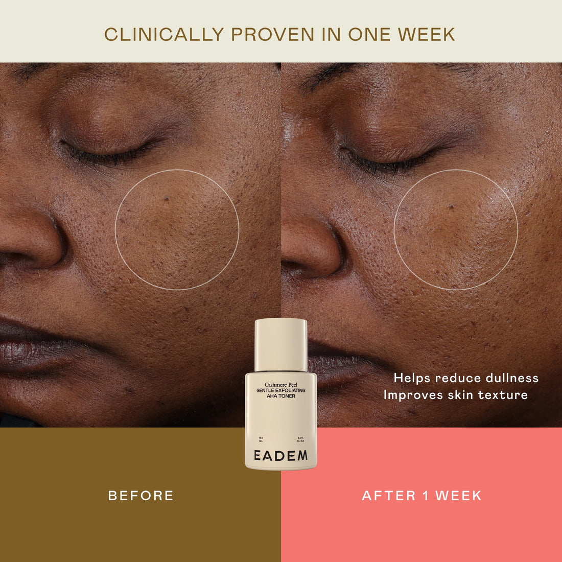 EADEM Gentle Exfoliating AHA & PHA Toner, Exfoliating Face Serum with Tranexamic Acid, AHA Exfoliant & Pore Minimizer for Face and Body, Acne Spot Serum, 5.0 oz, Cashmere Peel