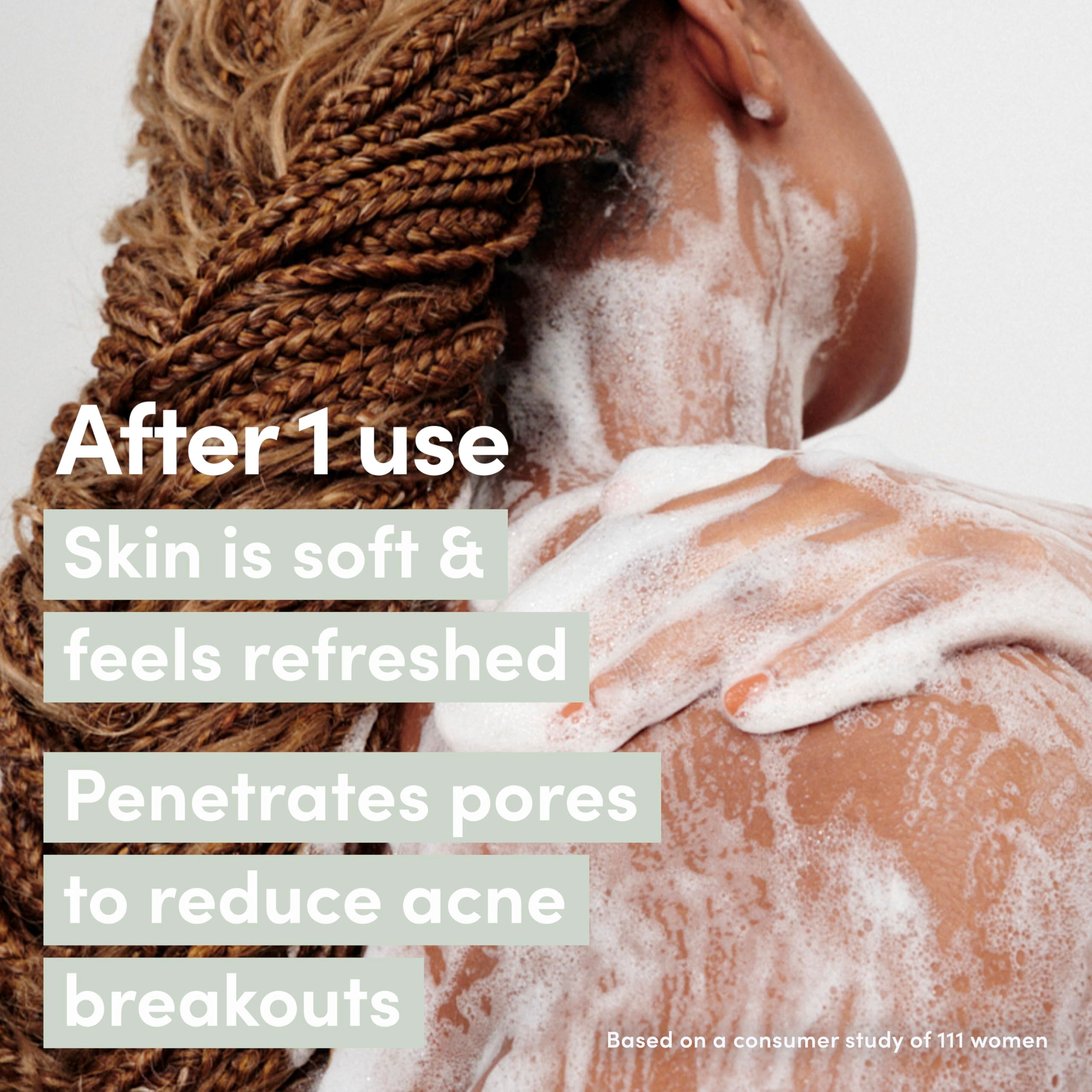 Dove Body Wash Acne Clears & helps prevent acne 1% clearing salicylic acid acne treatment 18.5 oz