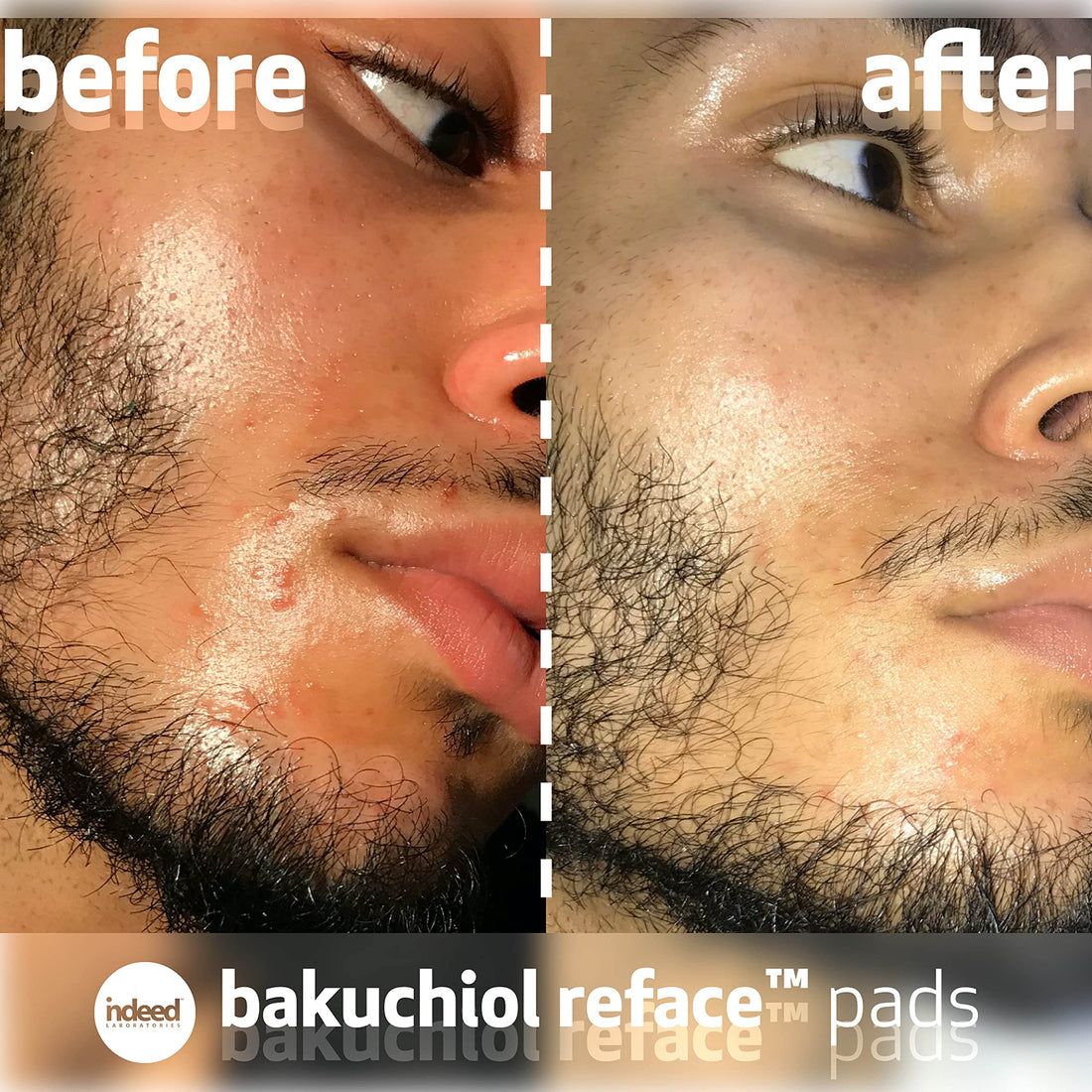 Indeed Laboratories Bakuchiol Reface Pads (30 pads)