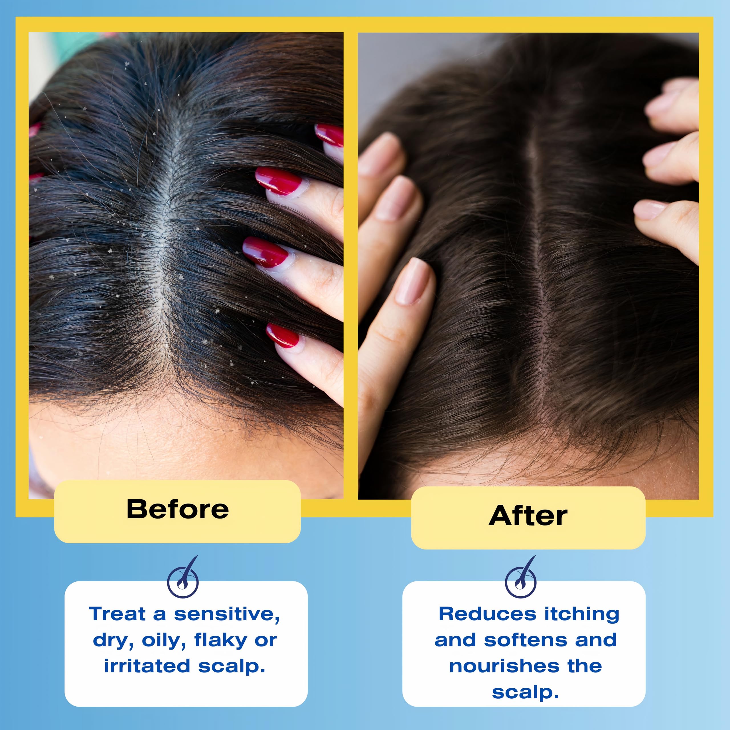 Therapro Mediceuticals Therapeutic Scalp & Hair Treatment Rinse - 8.45 oz by Therapro