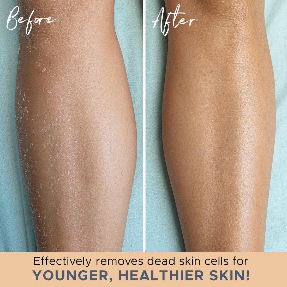 Exfoliating Glove (4 Pcs, 2 Pairs) - Medium Exfoliate Glove for Dead Skin Bath Exfoliating Gloves for Shower Spa Massage Body Scrub - Shower Gloves Exfoliating for Women & Men