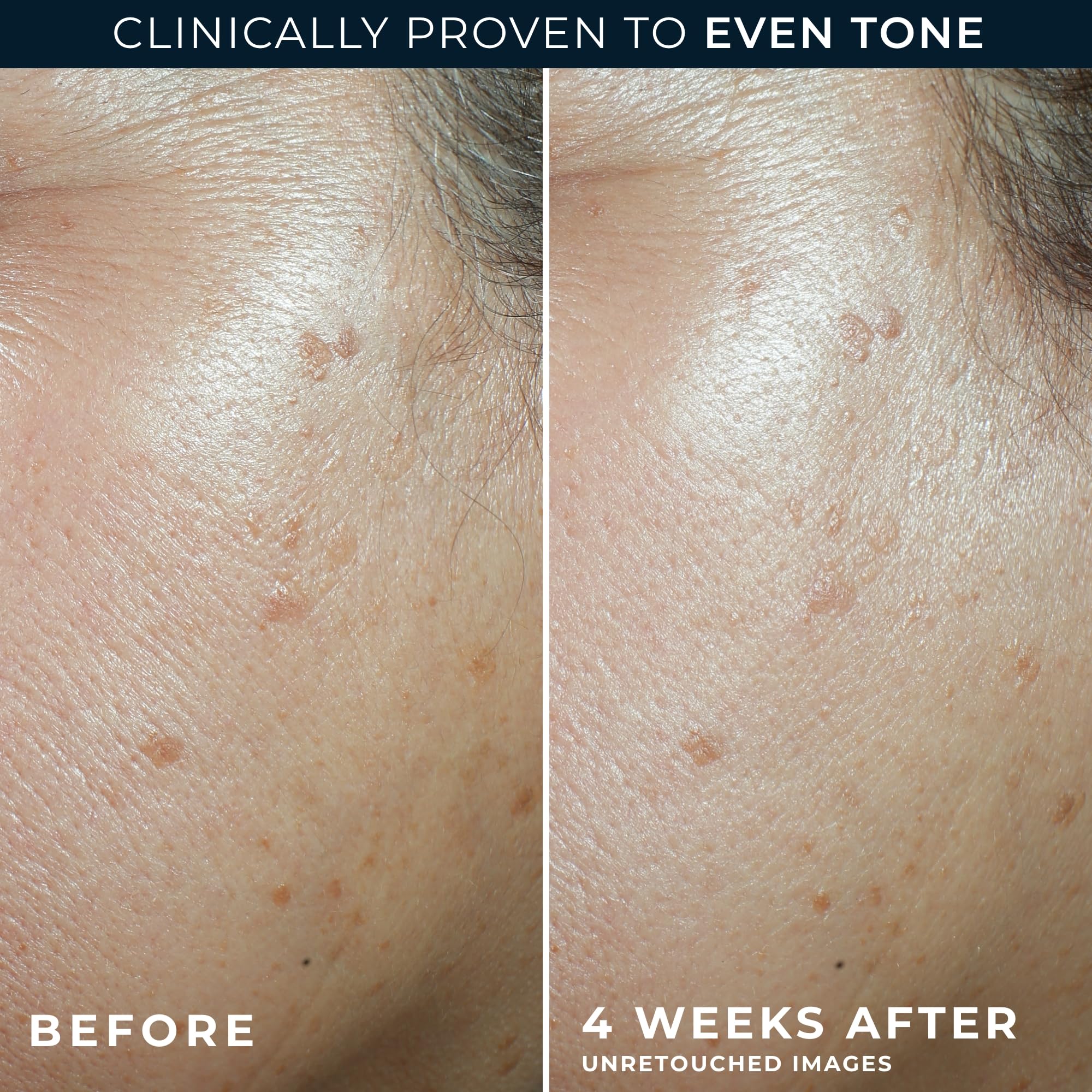 RoC Multi Correxion 5 in 1 Anti-Aging Daily Face Moisturizer with Broad Spectrum SPF 30 & Shea Butter, Skin Care Routine, (1.7 oz) with Night Cream Packette (Packaging May Vary)