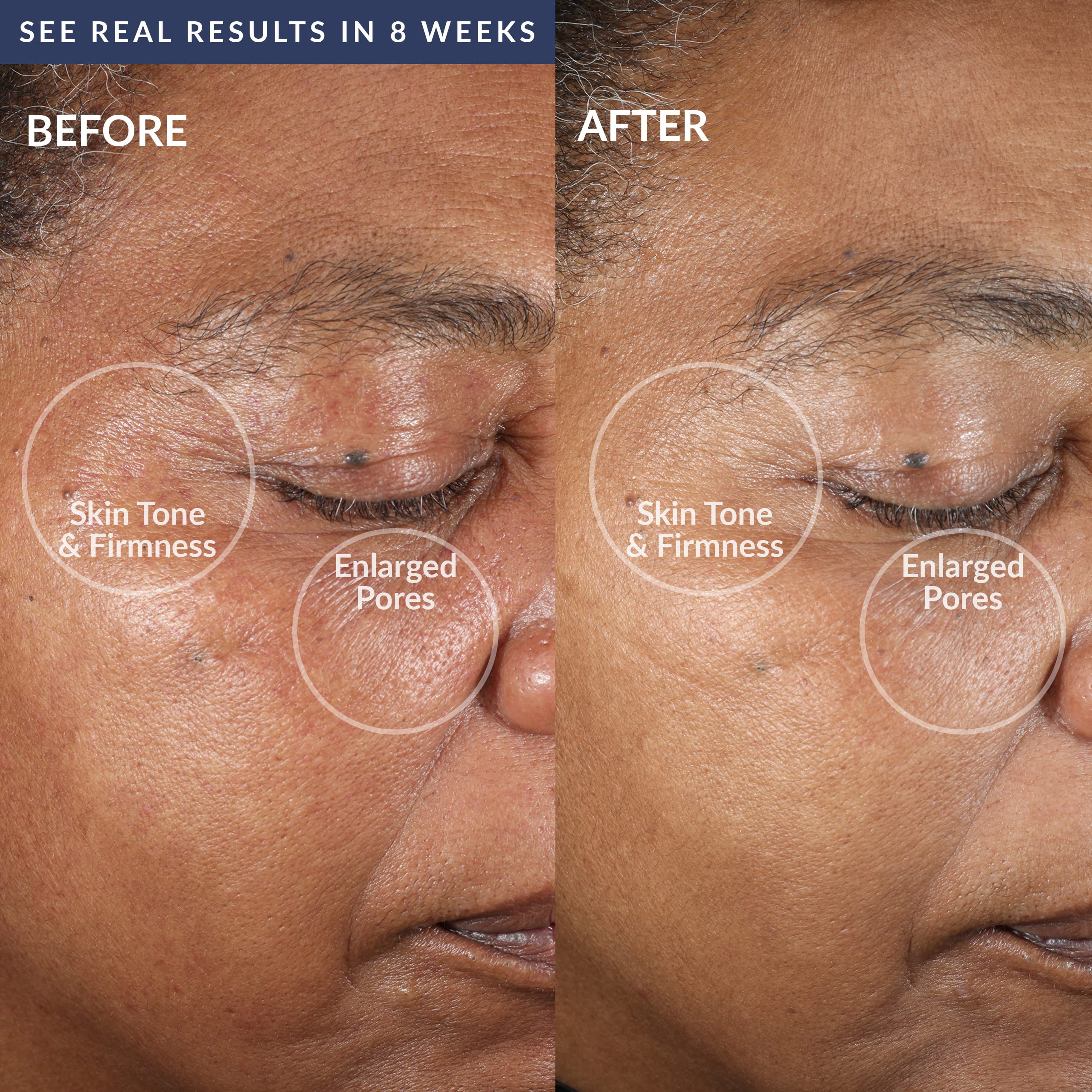 PMD Clean Pro - Smart Facial Cleansing Device with Silicone Brush & ActiveWarmth Anti-Aging Massager - Waterproof - SonicGlow Vibration Technology - Lift, Firm, and Tone Skin on Face and Body - Navy