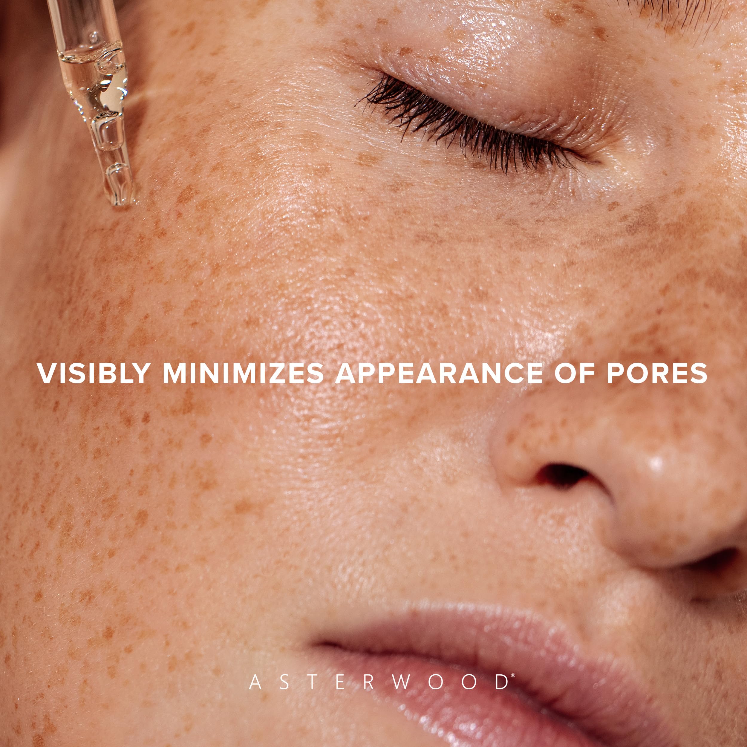 Asterwood Overnight Exfoliating Serum - AHA (Lactic Acid & Glycolic Acid) - BHA (Salicylic Acid) - Supports Improvement of Hyperpigmentation, Dark Spots - Fragrance-Free - 1 Fl Oz