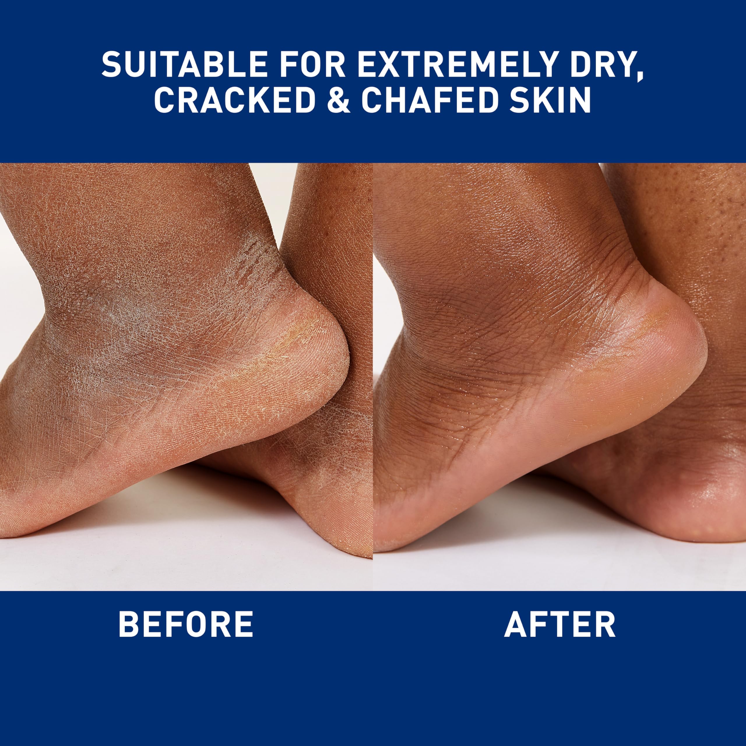 CeraVe Healing Ointment, Hydrating Skin Protectant With Petrolatum, Hyaluronic Acid & Ceramides, Face & Body Skin Barrier Repair For Cracked, Chafed, Dry Skin, Fragrance Free & Lanolin Free, 3 Oz