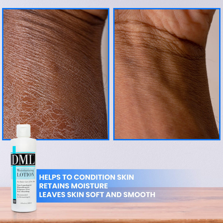 Dml Moisturizing Lotion, Fragrance Free - 8 Oz by DML