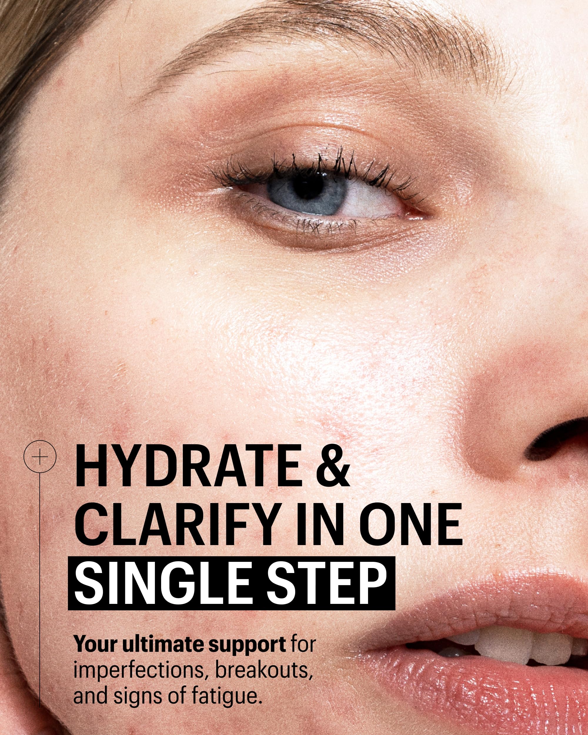 Allies of Skin Multi Nutrient & Dioic Renewing Cream: Moisturizer with Dioic Acid, 14 Antioxidants, Probiotics & Centella Asiatica. Targets Imperfections, Brightens & Protects Skin 1.7 oz / 50 ml