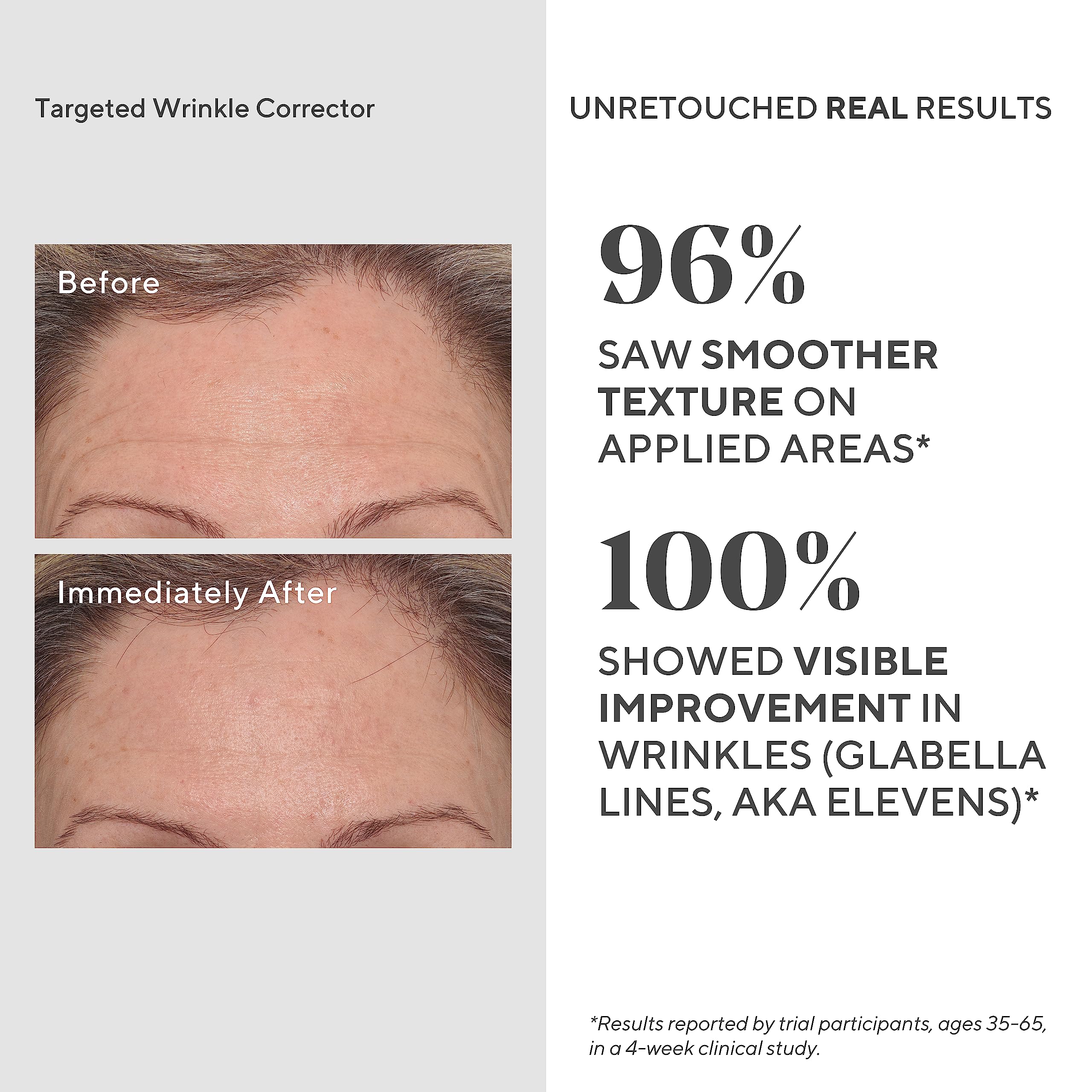 Murad Resurgence Treatment Value Set