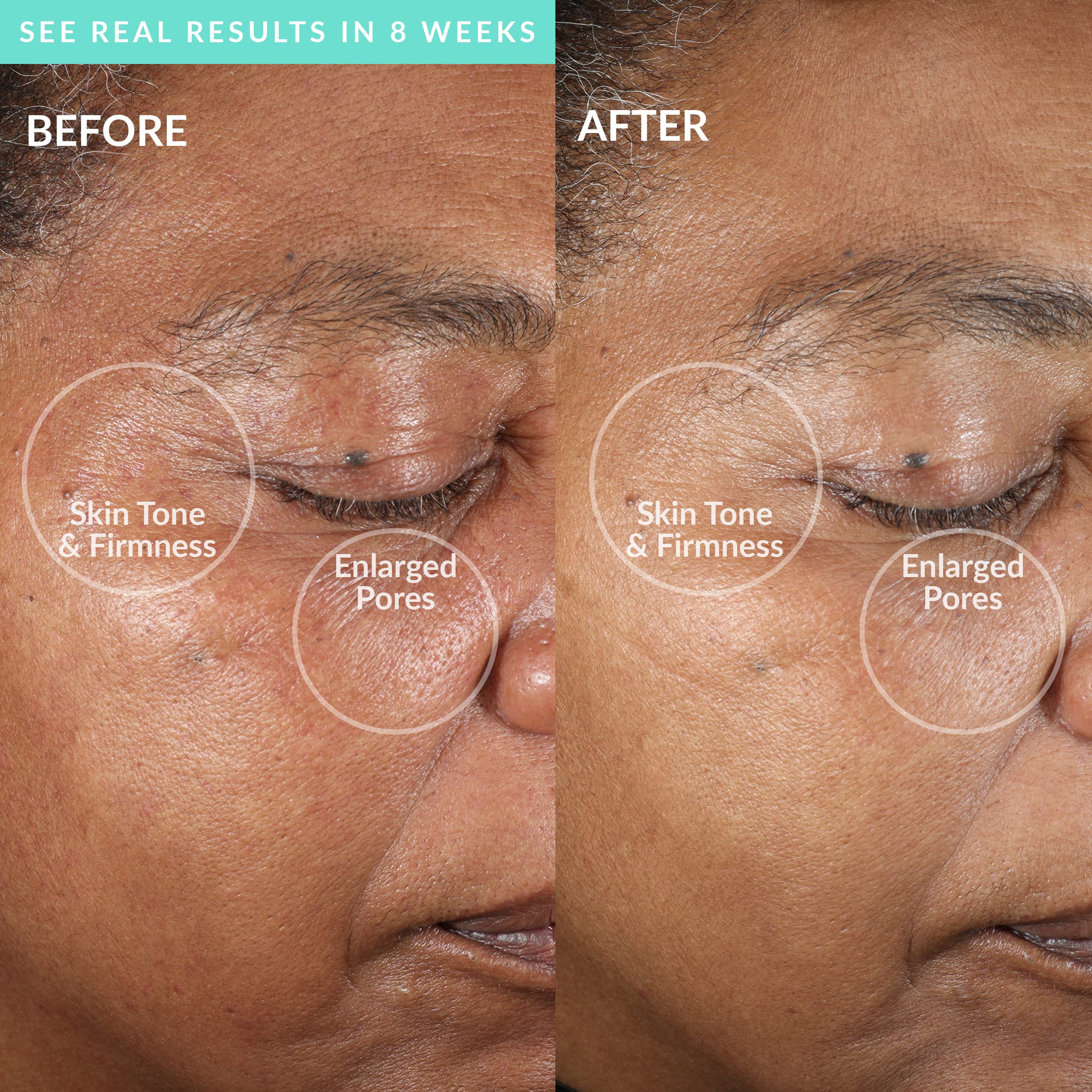 PMD Clean Pro - Smart Facial Cleansing Device with Silicone Brush & ActiveWarmth Anti-Aging Massager - Waterproof - SonicGlow Vibration Technology - Lift, Firm, and Tone Skin on Face and Body - Teal