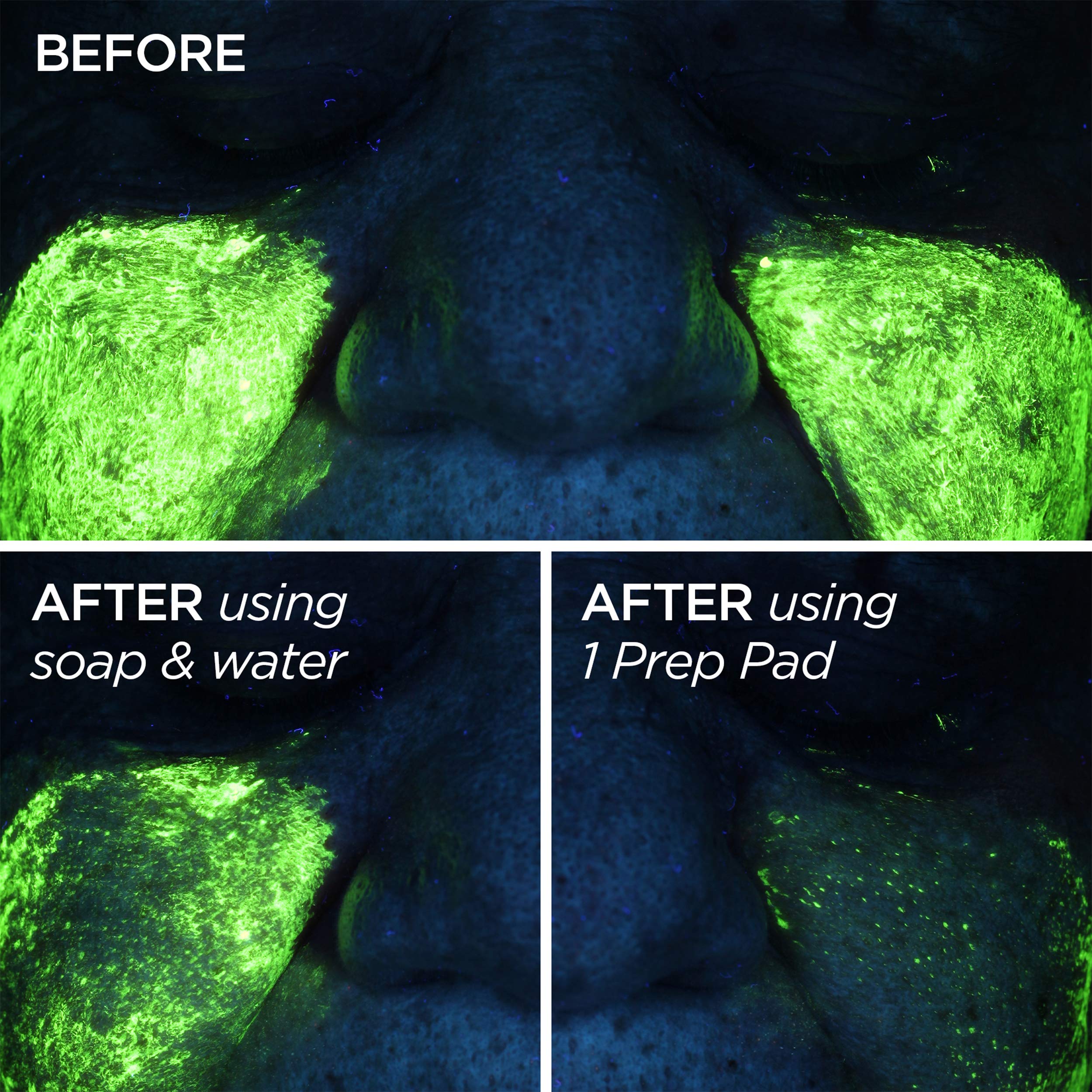 GloPRO Skin Prep Pads