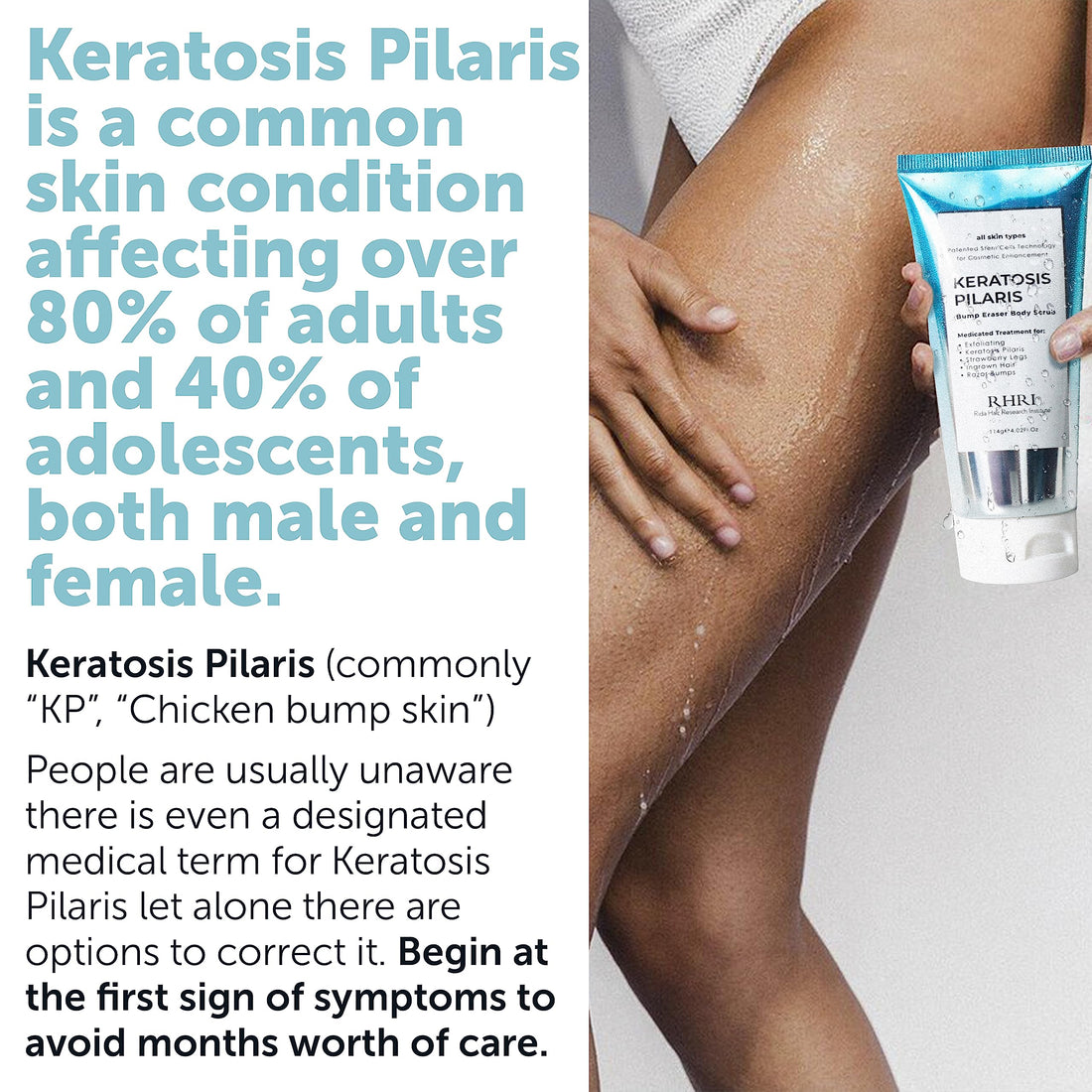 KP Bump Eraser Body Scrub, Keratosis Pilaris Treatment, Strawberry Legs Treatment for Women, Bump Eraser Body Scrub