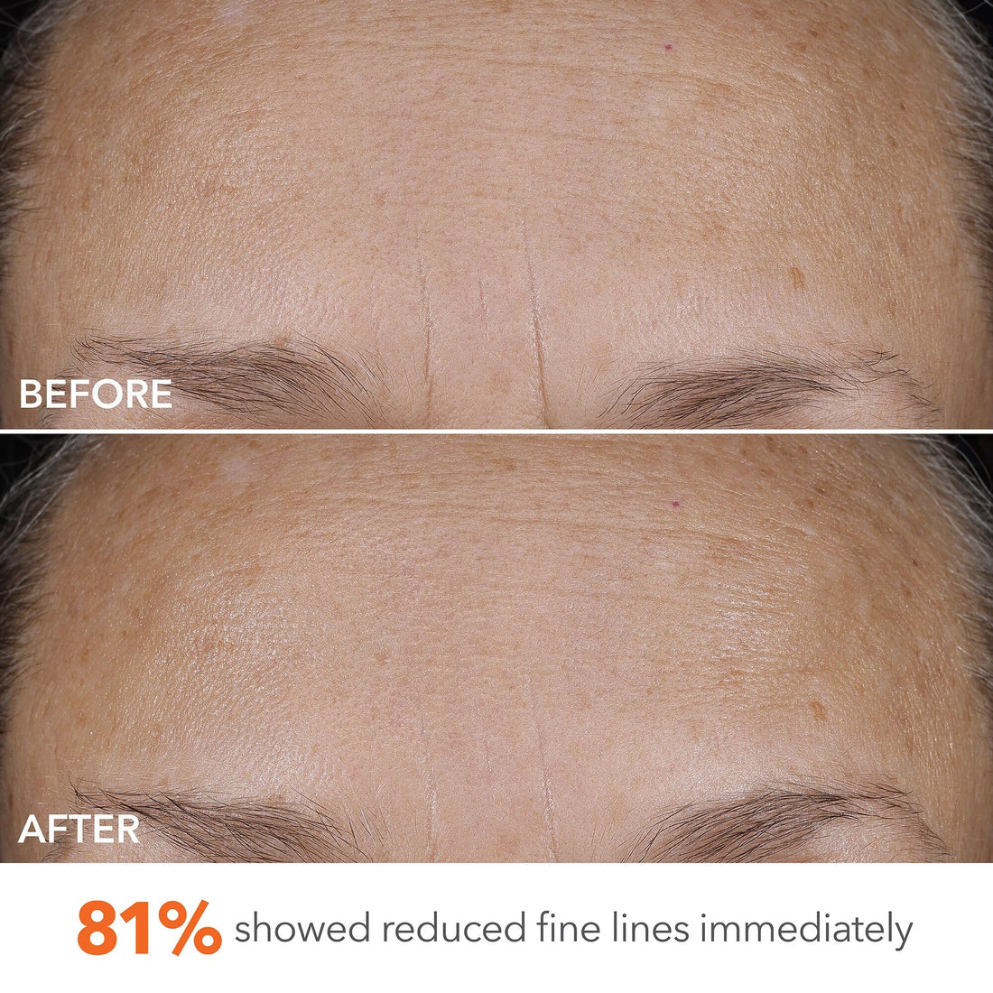 Dr Dennis Gross DermInfusions Blur + Repair Cream, Instantly Blurs Fine Lines, Smooths Skin with Satin-Matte Finish, Visibly Plumps & Firms, Reduces Redness, and Improves Skin Elasticity, 1.7 Fl Oz