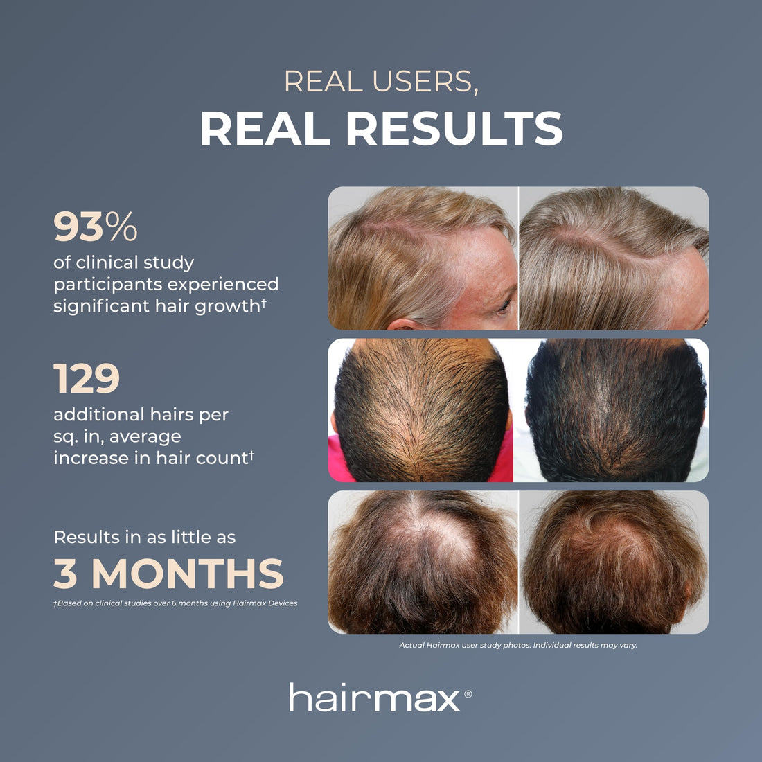 Hairmax Laser band41